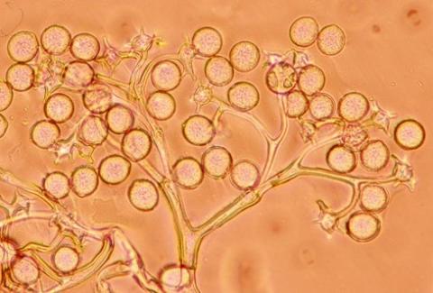 病原菌の分生子柄と分生子