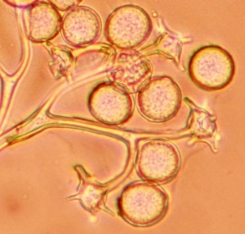 分生子柄先端の拡大