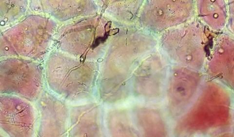 菌糸と病原菌の分生子柄の画像