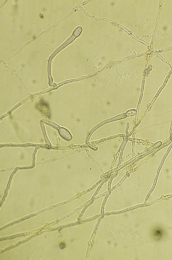 病原菌の菌糸から生じた分生子柄と分生子の画像