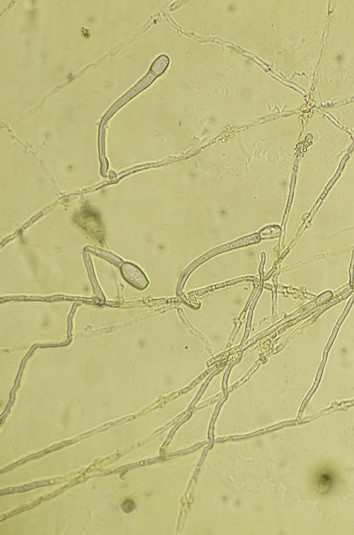 病原菌の菌糸から生じた分生子柄と分生子の画像