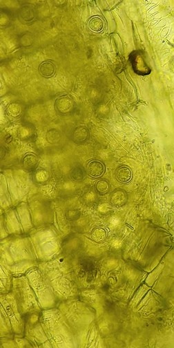 病原菌の卵胞子の画像
