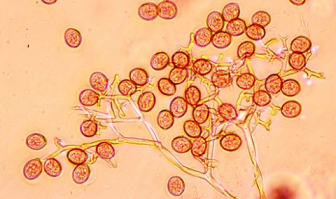 病原菌の分生子柄と分生子の画像