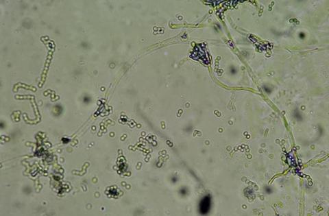 病原菌の分生子の画像