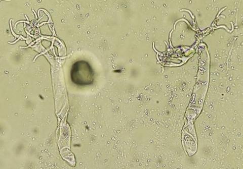 病原菌の分生子柄の画像