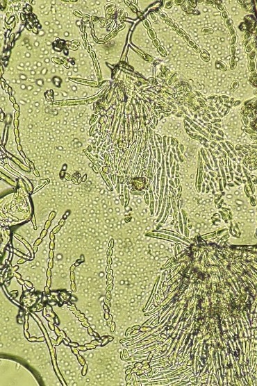 病原菌の分生子の画像