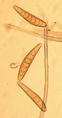 病原菌の分生子の画像