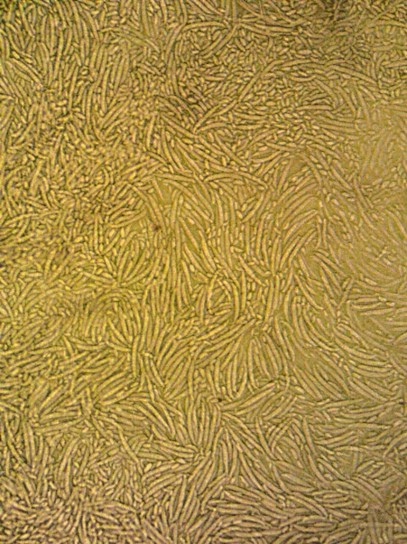 病原菌の分生子塊の画像
