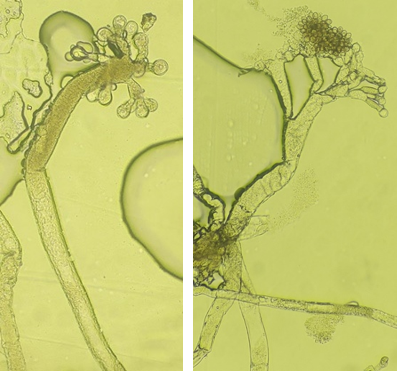 病原菌の胞子のう柄と胞子のうの画像