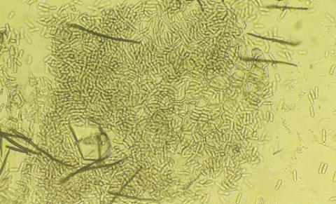 病原菌の分生子と剛毛の画像