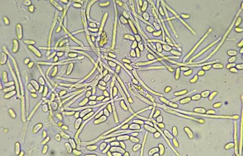 病原菌の子型分生子の画像