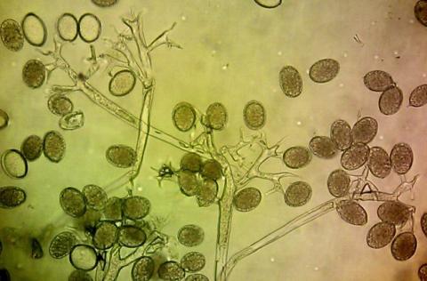 病原菌の分生子の画像