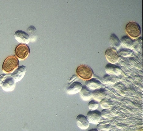 病原菌の夏胞子の画像
