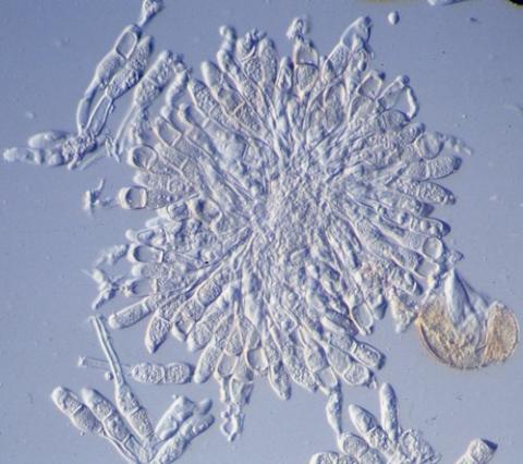 病原菌の冬胞子の画像