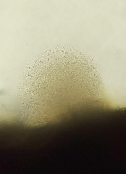 黒変葉脈から流出する病原細菌の画像