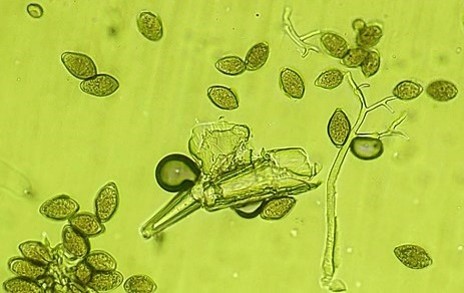 病原菌の分生子柄と分生子の画像