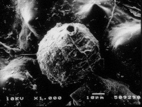 分生子殻の電子顕微鏡画像