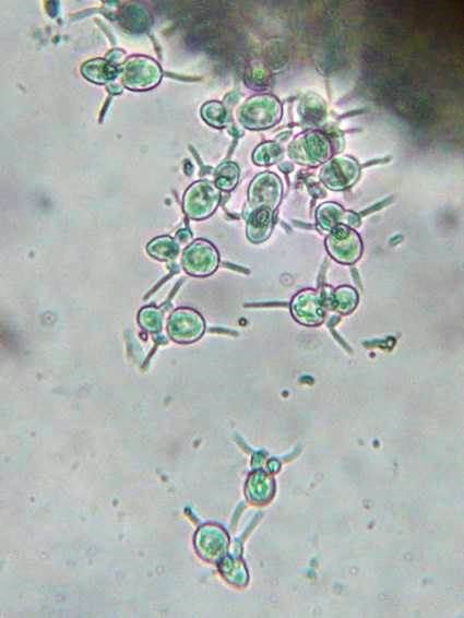 病原菌の分生子の画像