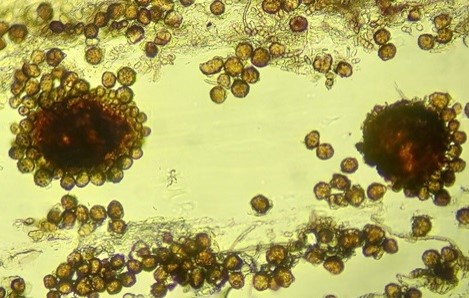 病原菌の分生子座と分生子