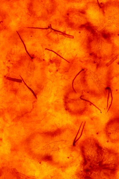 病原菌の剛毛の画像