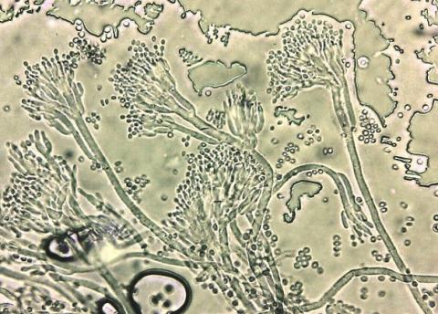 病原菌の分生子柄と分生子の画像