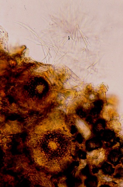 病原菌の分生子殻と分生子の画像