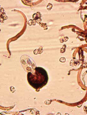 病原菌の毛状細胞と子のう殻から顔を出す子のうと子のう胞子の画像
