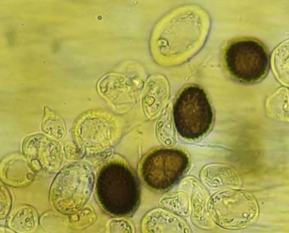 病原菌の厚壁胞子の画像