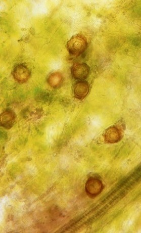 黄褐色の卵胞子の画像