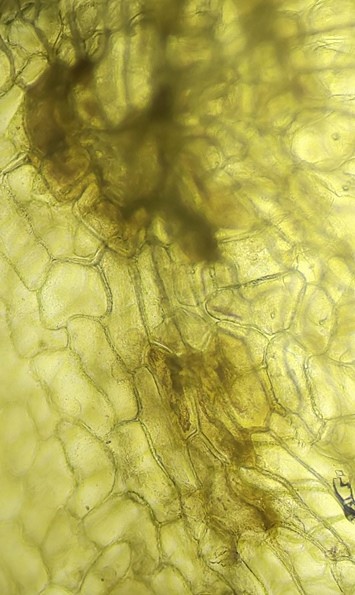 病原細菌の増殖の画像