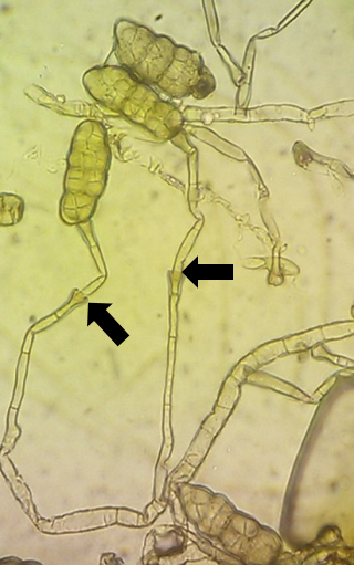 病原菌の分生子柄と分生子の画像