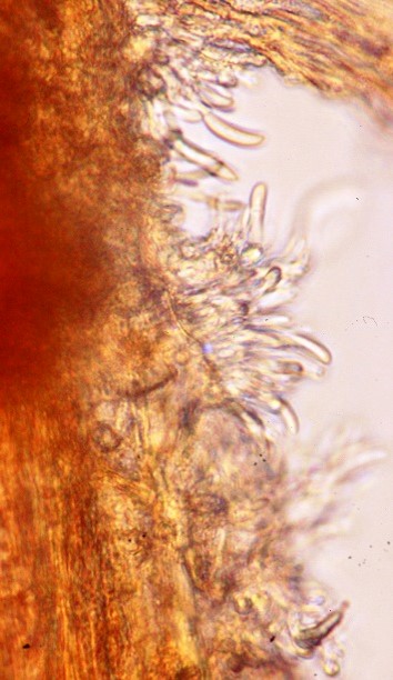 病原菌の分生子座の画像