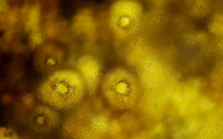 病原菌の分生子殻の画像