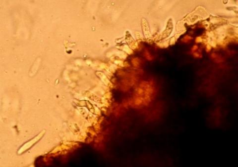 病原菌の分生子層の画像