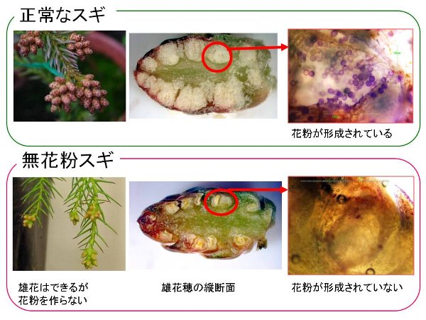 スギ雄花穂の縦断面