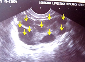 超音波診断装置モニター映像（矢印部分が卵胞）